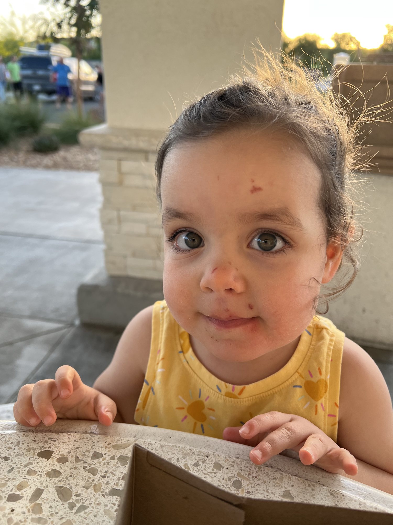 Poor Nori fell on some gravel the previous day :(.